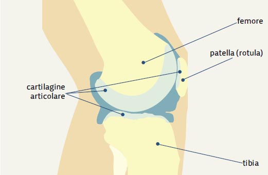 artrosi-del-ginocchio-ecco-cosa-serve